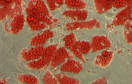 stem cells